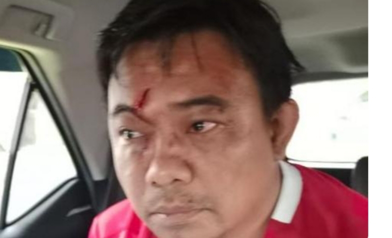 Ketua Umum DPP KNPI Haris Pertama Dilarikan ke RSCM