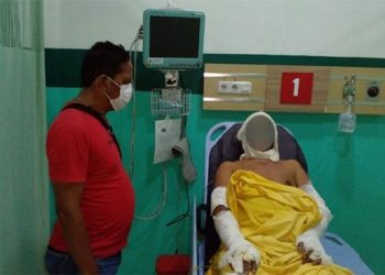 Tabung Gas Picu Kebakaran di Warung Bakso Deli Serdang, 1 Orang Menderita Luka Bakar