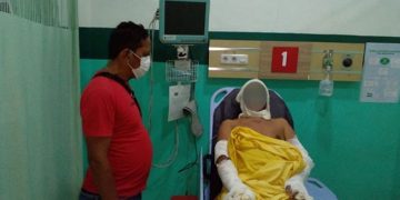 Tabung Gas Picu Kebakaran di Warung Bakso Deli Serdang, 1 Orang Menderita Luka Bakar