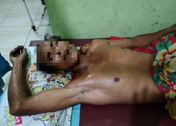 Ketahuan Cabuli Anak Tirinya, Darusman Nainggolan Bunuh Diri