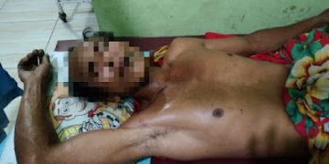 Ketahuan Cabuli Anak Tirinya, Darusman Nainggolan Bunuh Diri
