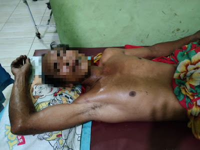 Ketahuan Cabuli Anak Tirinya, Darusman Nainggolan Bunuh Diri