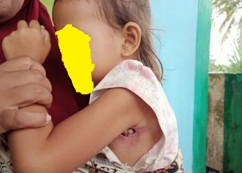 Kisah Pilu Bocah Penderita Infeksi, Tak Bisa Berobat karena Himpitan Ekonomi