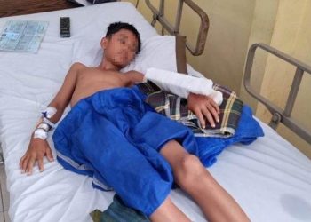 Siswa SMP yang ditebas parang oleh diduga geng motor sudah enam kali pindah rumah sakit