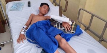 Siswa SMP yang ditebas parang oleh diduga geng motor sudah enam kali pindah rumah sakit