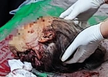 TRAGIS!!! Ditemukan Kepala Korban Dugaan Pembunuhan
