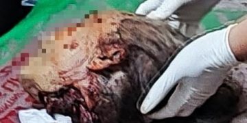 TRAGIS!!! Ditemukan Kepala Korban Dugaan Pembunuhan